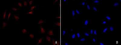 Immunocytochemistry/ Immunofluorescence: GADD153/CHOP Antibody [NBP2-98741]