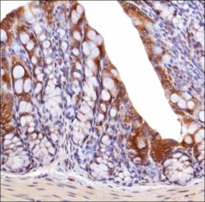 Immunohistochemistry: GADD153/CHOP Antibody - BSA Free [NBP2-13172]