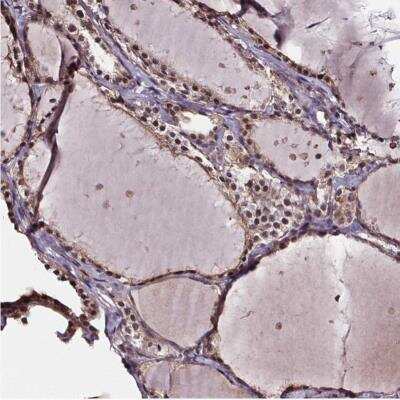 Immunohistochemistry-Paraffin: GADD153/CHOP Antibody [NBP2-49550]