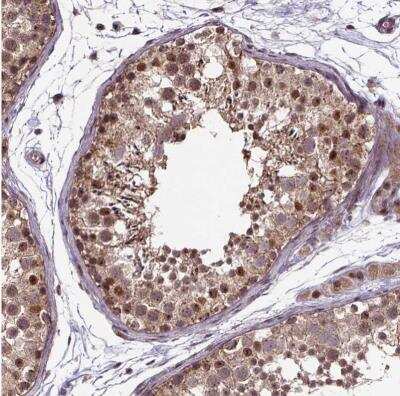Immunohistochemistry-Paraffin: GADD153/CHOP Antibody [NBP2-49550]