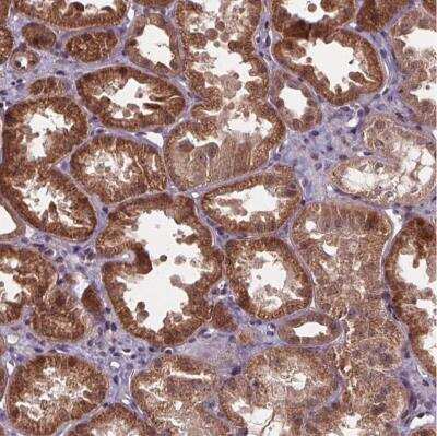 Immunohistochemistry-Paraffin: GADD153/CHOP Antibody [NBP2-49550]