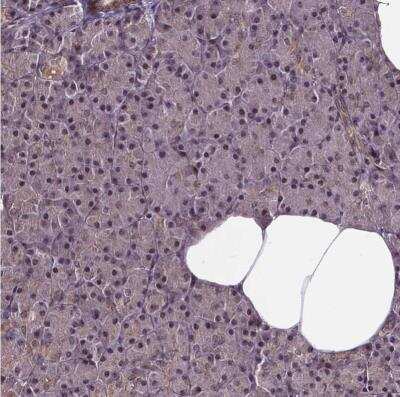 Immunohistochemistry-Paraffin: GADD153/CHOP Antibody [NBP2-49550]