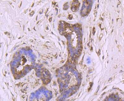 Immunohistochemistry-Paraffin: GADD153/CHOP Antibody (JM10-31) [NBP2-66856]