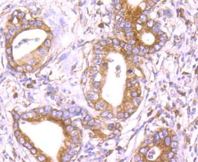 Immunohistochemistry-Paraffin: GADD153/CHOP Antibody (JM10-31) [NBP2-66856]
