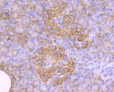 Immunohistochemistry-Paraffin: GADD153/CHOP Antibody (JM10-31) [NBP2-66856]