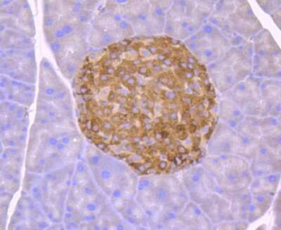 Immunohistochemistry-Paraffin: GADD153/CHOP Antibody (JM10-31) [NBP2-66856]