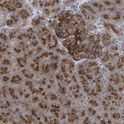 Immunohistochemistry-Paraffin: GADD34 Antibody [NBP1-89800]