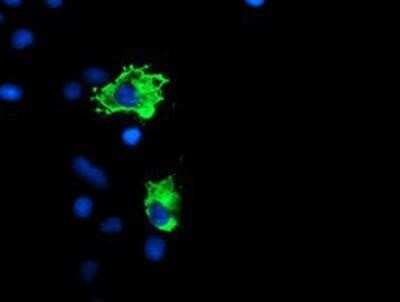 Immunocytochemistry/ Immunofluorescence: GADD34 Antibody (OTI3D12) [NBP2-01787]