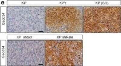 Immunohistochemistry: GADD34 Antibody (OTI3D12) [NBP2-01787]