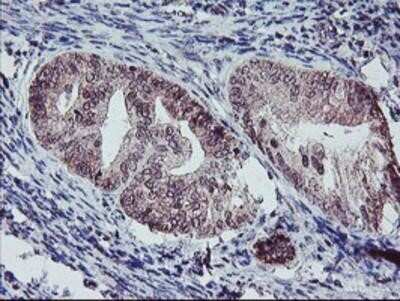 Immunohistochemistry-Paraffin: GADD34 Antibody (OTI3D12) [NBP2-01787]