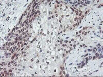 Immunohistochemistry-Paraffin: GADD34 Antibody (OTI3D12) [NBP2-01787]