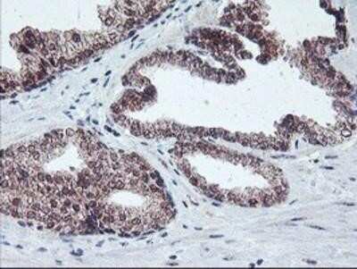 Immunohistochemistry-Paraffin: GADD34 Antibody (OTI3D12) [NBP2-01787]