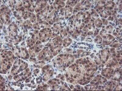 Immunohistochemistry-Paraffin: GADD34 Antibody (OTI3D12) [NBP2-01787]