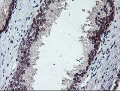 Immunohistochemistry-Paraffin: GADD34 Antibody (OTI3D12) [NBP2-01787]