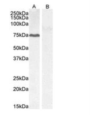 Western Blot: GADD34 Antibody [NB100-778]