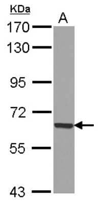 Western Blot: GADD34 Antibody [NBP2-16575]