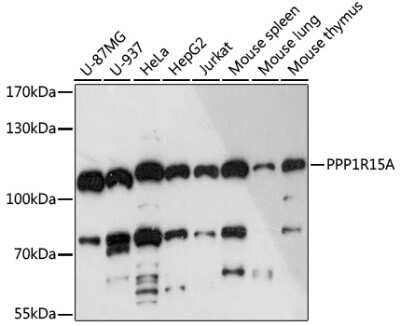 Western Blot: GADD34 AntibodyAzide and BSA Free [NBP3-03703]