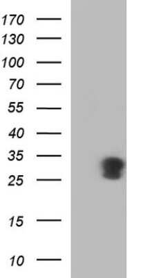 Western Blot: GADD45 alpha Antibody (OTI1C9) [NBP2-45806]