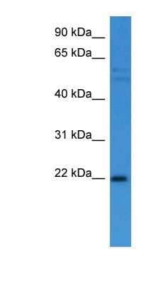 Western Blot: GADD45 alpha Antibody [NBP1-79791]