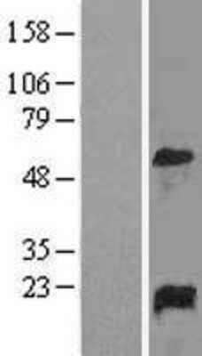 Western Blot: GADD45 alpha Overexpression Lysate [NBL1-10934]