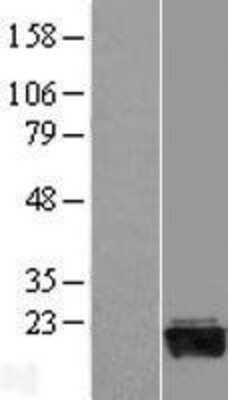 Western Blot: GADD45G Overexpression Lysate [NBL1-10935]