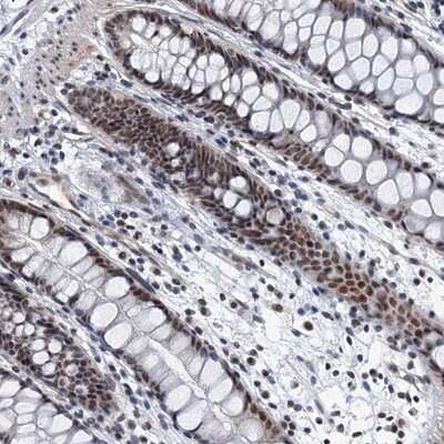 Immunohistochemistry-Paraffin: GADL1 Antibody [NBP1-85852]