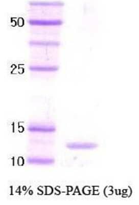 SDS-PAGE: Recombinant Drosophila GAGA-POZ domain Protein [NBC1-18417]