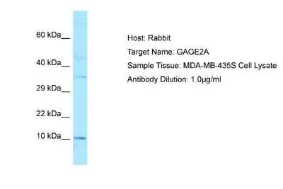 Western Blot: GAGE-2A Antibody [NBP1-98298]