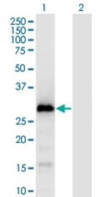 Western Blot: GAGE1 Antibody (4G6) [H00002543-M04]