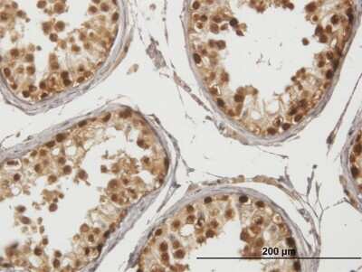 Immunohistochemistry-Paraffin: GAGE1 Antibody [H00002543-B01P]