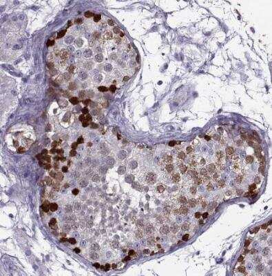 Immunohistochemistry-Paraffin: GAGE1 Antibody [NBP2-54704]