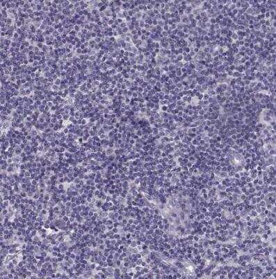 Immunohistochemistry-Paraffin: GAGE1 Antibody [NBP2-54704]