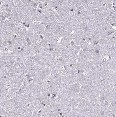 Immunohistochemistry-Paraffin: GAGE1 Antibody [NBP2-54704]
