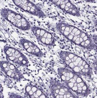 Immunohistochemistry-Paraffin: GAGE1 Antibody [NBP2-54704]