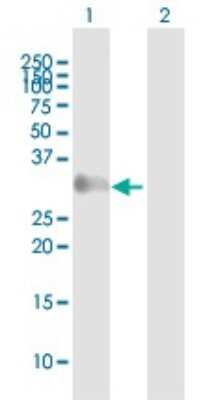 Western Blot: GAGE1 Antibody [H00002543-B01P]