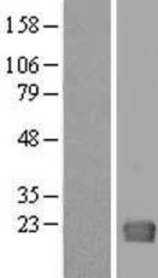 Western Blot: GAGE1 Overexpression Lysate [NBL1-10938]