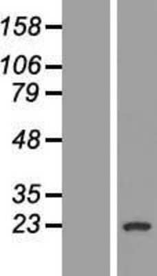 Western Blot: GAGE1 Overexpression Lysate [NBP2-08204]