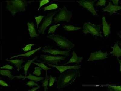 Immunocytochemistry/ Immunofluorescence: GAGE5 Antibody (8F8) [H00002577-M06]