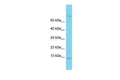 Western Blot: GAGE6 Antibody [NBP3-09602]