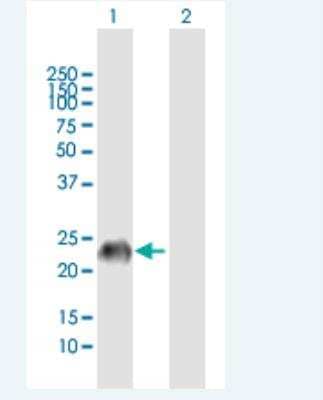 Western Blot: GAGE7 Antibody [H00002579-B01P-50ug]