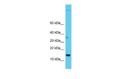 Western Blot: GAGE7 Antibody [NBP3-09603]