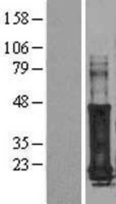 Western Blot: GAGE7 Overexpression Lysate [NBL1-10939]