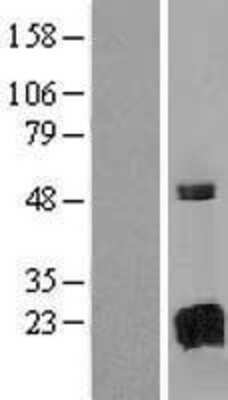 Western Blot: GAGE8 Overexpression Lysate [NBL1-10940]