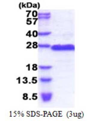 SDS-PAGE: Recombinant Human GAGE8 His Protein [NBP2-23067]