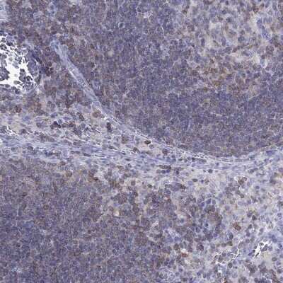 Immunohistochemistry-Paraffin: GAJ Antibody [NBP2-62609]