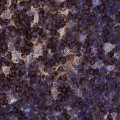Immunohistochemistry-Paraffin: GAJ Antibody [NBP2-62609]