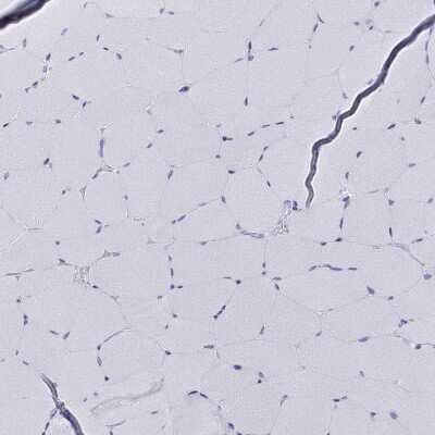 Immunohistochemistry-Paraffin: GAJ Antibody [NBP2-62609]