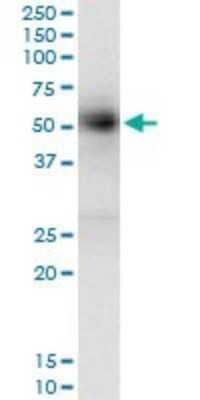 Immunoprecipitation: GAK Antibody (4C10) [H00002580-M01]