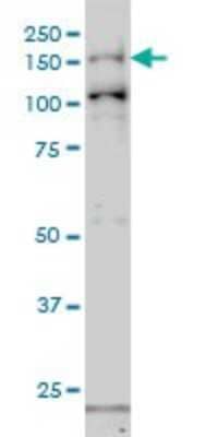 Western Blot: GAK Antibody (4C10) [H00002580-M01]