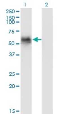 Western Blot: GAK Antibody (4C10) [H00002580-M01]